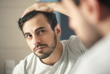 Est-ce possible de reprendre directement le travail après une greffe de cheveux ?