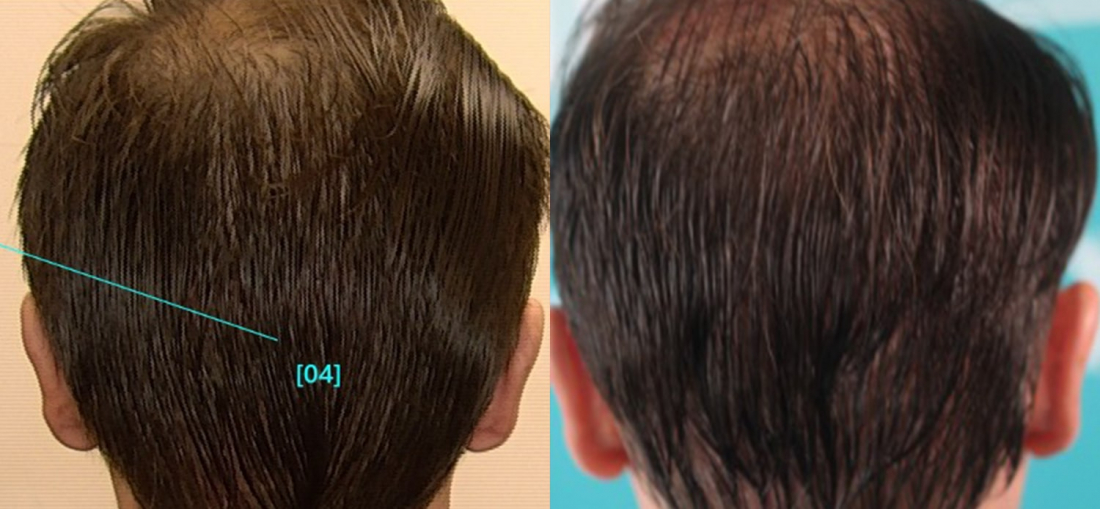 Before and after sampling