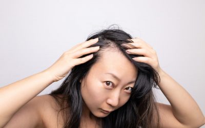 La greffe de cheveux est-elle réservée aux hommes ?