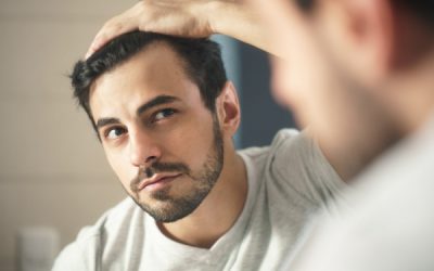 Greffes de cheveux à l’étranger ou en France ?