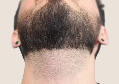 barbe cou