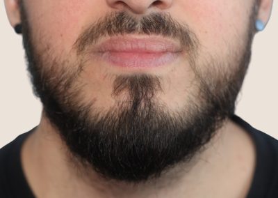 barbe face