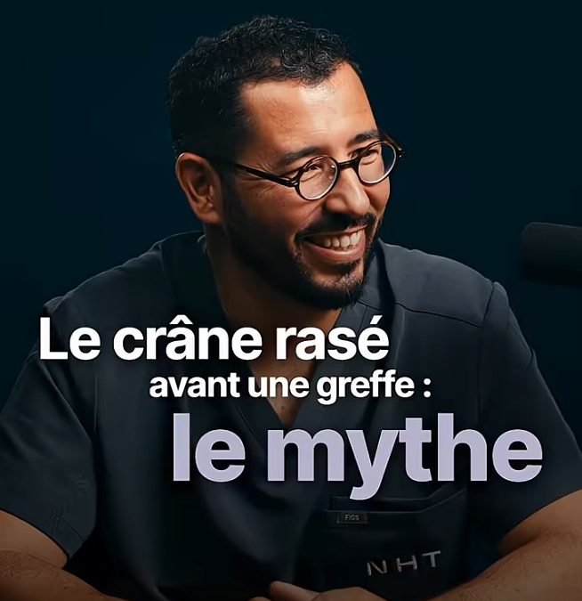 Faut-il se raser la tête avant une greffe de cheveux ?