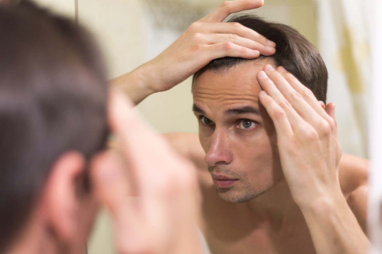 perte de cheveux quand reagir